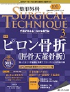 整形外科 Surgical Technique
