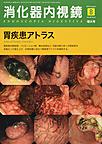 消化器内視鏡　増大号<Vol.28No.8>　胃疾患アトラス