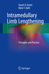 Intramedullary Limb Lengthening:Principles and Practice