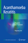 Acanthamoeba Keratitis:Diagnosis and Treatment