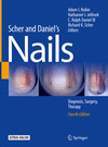 Scher and Daniel's Nails:Diagnosis, Surgery, Therapy