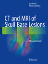 CT and MRI of Skull Base Lesions:A Diagnostic Guide