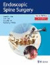 Endoscopic Spine Surgery