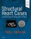 Structural Heart Cases:A Color Atlas of Pearls and Pitfalls