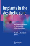 Implants in the Aesthetic Zone:A Guide for Treatment of the Partially Edentulous Patient