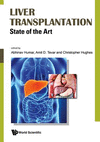 Liver Transplantation:State of the Art