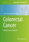 Colorectal Cancer:Methods and Protocols