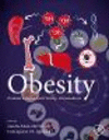 Obesity:Oxidative Stress and Dietary Antioxidants