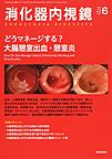消化器内視鏡<Vol.30No.6(2018June)> どうマネージする?大腸憩室出血・憩室炎