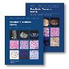 Paediatric Tumours Part A and Part B (2 Volumes) 5th ed.(WHO Classification of Tumours Vol. 7) paper 1228 p. 23