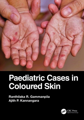 Paediatric Cases in Coloured Skin '23