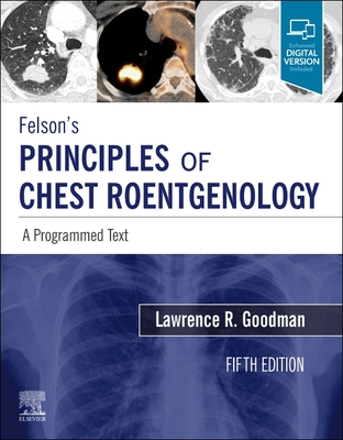 Felson's Principles of Chest Roentgenology, A Programmed Text 5th ed. paper 288 p. 20