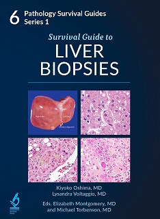 Survival Guide to Liver Biopsies(Pathology Survival Guides, Series 1 Vol. 6) hardcover 21