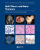 Soft Tissue and Bone Tumours 5th ed.(WHO Classification of Tumours Vol. 3) paper 368 p. 20