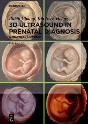 3D Ultrasound in Prenatal Diagnosis:A Practical Approach, 2nd ed. '24