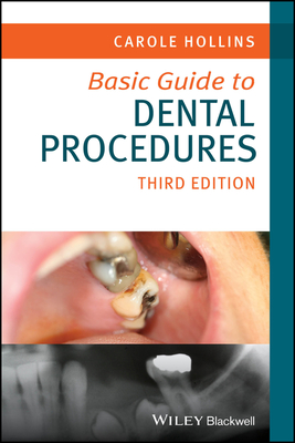 Basic Guide to Dental Procedures, 3rd ed. (Basic Guide Dentistry) '24