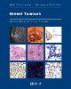 Breast Tumours 5th ed.(WHO Classification of Tumours Vol. 2) paper 368 p. 19