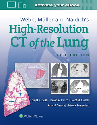 Webb, Müller and Naidich's High-Resolution CT of the Lung 6th ed. hardcover 728 p. 21