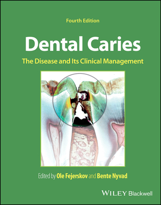 Dental Caries:The Disease and its Clinical Management, 4th ed. '24