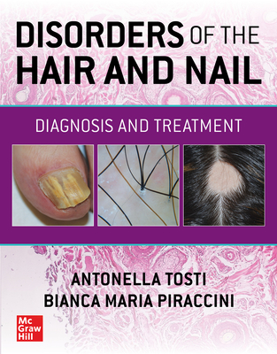 Disorders of the Hair and Nail:Diagnosis and Treatment '23