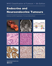 Endocrine and Neuroendocrine Tumours 5th ed.(WHO Classification of Tumours Vol. 10) paper 608 p. 25