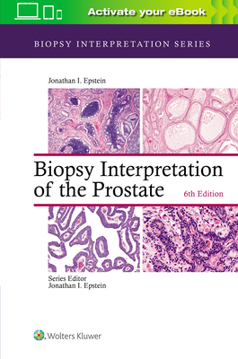Biopsy Interpretation of the Prostate 6th ed.(Biopsy Interpretation) hardcover 436 p. 20