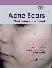 Acne Scars P 144 p. 19