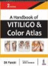 A Handbook of Vitiligo and Color Atlas 2nd ed. P 146 p. 17