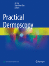 Practical Dermoscopy 1st ed. 2022 P 23