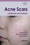 Acne Scars(Series in Dermatological Treatment) H 144 p. 09