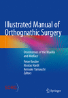Illustrated Manual of Orthognathic Surgery:Osteotomies of the Maxilla and Midface '24