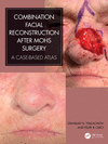 Combination Facial Reconstruction After Mohs Surgery: A Case Based Atlas H 186 p. 23