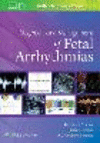 Diagnosis and Management of Fetal Arrhythmias '20