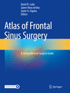 Atlas of Frontal Sinus Surgery:A Comprehensive Surgical Guide '23