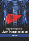 New Frontiers in Liver Transplantation H 191 p. 19