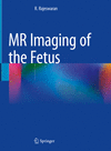 MR Imaging of the Fetus '22
