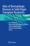 Atlas of Dermatologic Diseases in Solid Organ Transplant Recipients '23