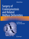 Surgery of Craniosynostosis and Related Midface Deformities 2024th ed. H 24