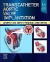Transcatheter Aortic Valve Implantation '22