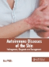Autoimmune Diseases of the Skin: Pathogenesis, Diagnosis and Management H 252 p. 23