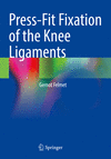 Press-Fit Fixation of the Knee Ligaments '24
