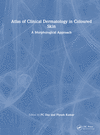 Atlas of Clinical Dermatology in Coloured Skin:A Morphological Approach '23