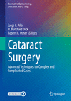 Cataract Surgery:Advanced Techniques for Complex and Complicated Cases (Essentials in Ophthalmology) '23
