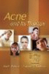 Acne and Its Therapy (Basic and Clinical Dermatology) '07