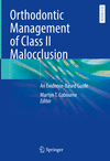 Orthodontic Management of Class II Malocclusion:An Evidence-Based Guide '24