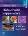 A Comprehensive Guide to Hidradenitis Suppurativa '21