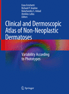Clinical and Dermoscopic Atlas of Non-Neoplastic Dermatoses:Variability According to Phototypes '23