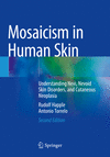 Mosaicism in Human Skin:Understanding Nevi, Nevoid Skin Disorders, and Cutaneous Neoplasia, 2nd ed. '23