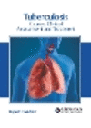 Tuberculosis: Causes, Clinical Assessment and Treatment H 246 p. 23