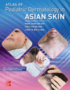 Atlas of Pediatric Dermatology in Asian Skin paper 512 p. 24